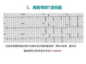 标签算法的核心逻辑与匹配度敏感性