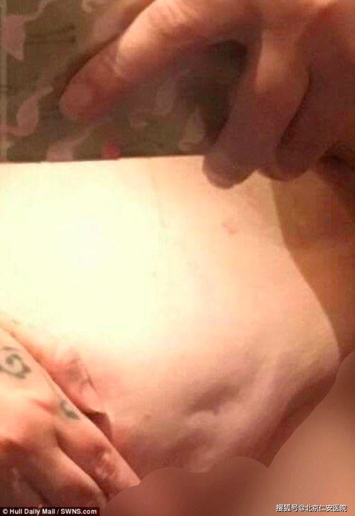 二、 新店初期补单的考量