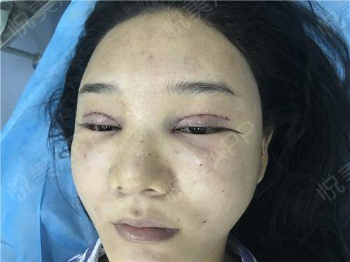 三、 案例分析：垂直细分领域的美妆账号